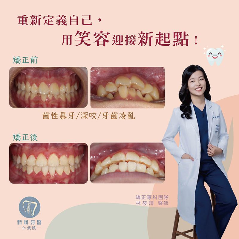 新悅美學牙醫診所的案例分享圖片